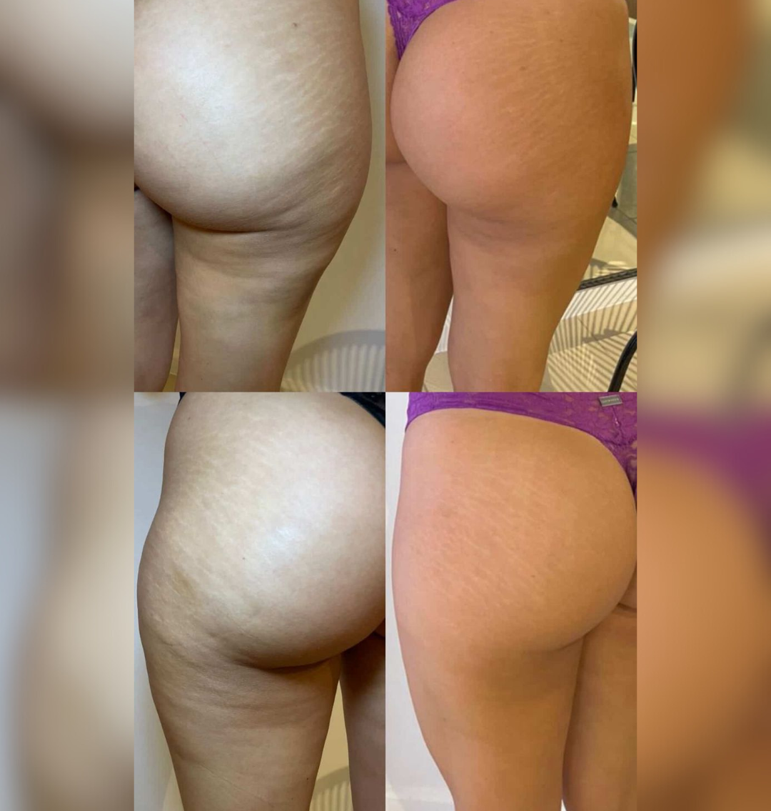 Resultado Celu Slim